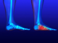Flat Feet Types